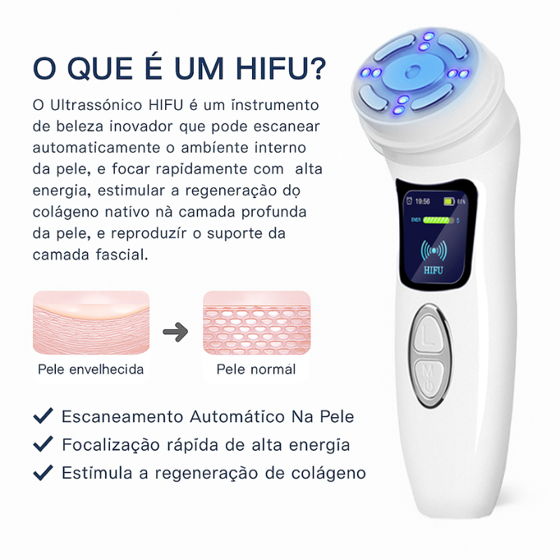Mini HIFU 4ª Geração para Rosto