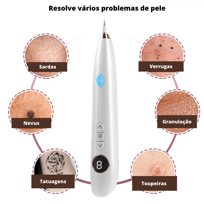 Caneta Jato de Plasma Removedora de Manchas Verrugas Acnes Sinais e Pontos Pretos