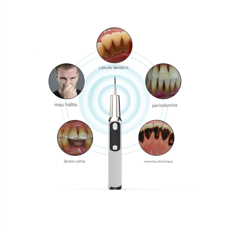 Removedor de Tártaro Dental Ultrassônico Delopar - 9 Velocidades