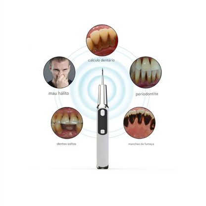 Removedor de Tártaro Dental Ultrassônico Delopar - 9 Velocidades